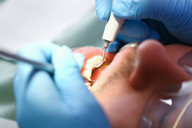 Best After-Hours Dental Care in Wapello, IA