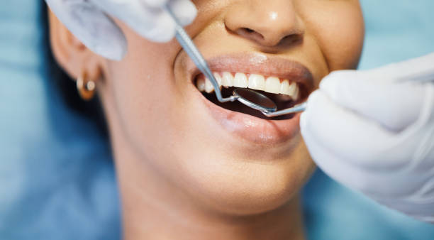 Best Emergency Dental Care for Sports Injuries in Wapello, IA