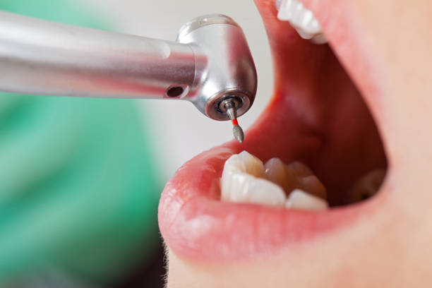Best Walk-In Emergency Dental Services in Wapello, IA